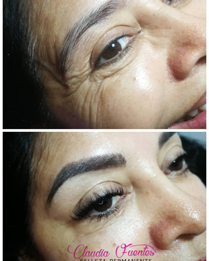 Estética facial